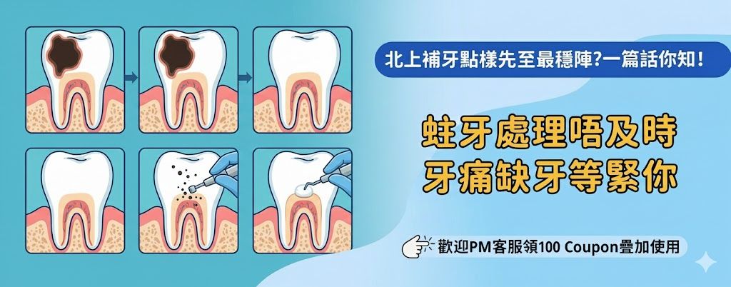 北上補牙值得安排時間嗎?