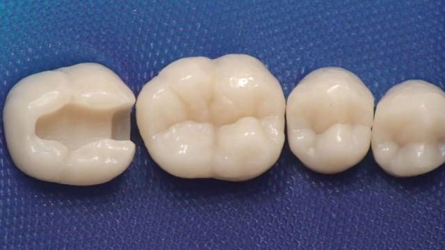 What to Expect at a Follow-up Dental Appointment in Chinese Mainland