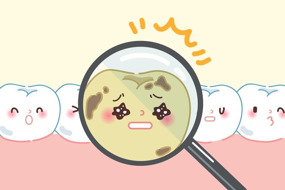 Can Dental Fillings Be Completed in One Visit To Chinese Mainland