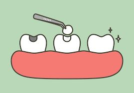 Understanding Real and Fake Reviews Before Dental Work To Chinese Mainland