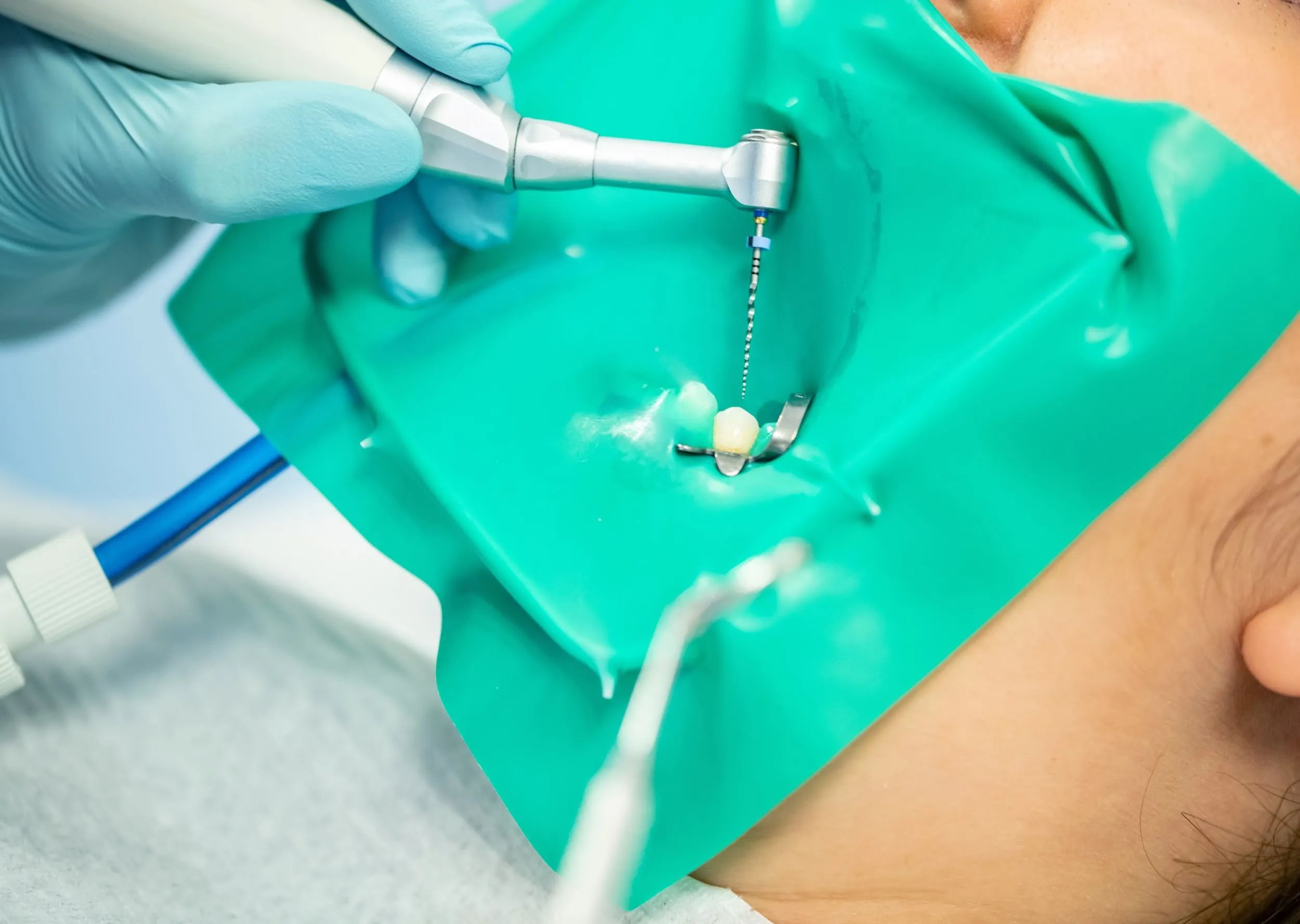 Should You Schedule Dental Appointments Early When Traveling to Chinese Mainland