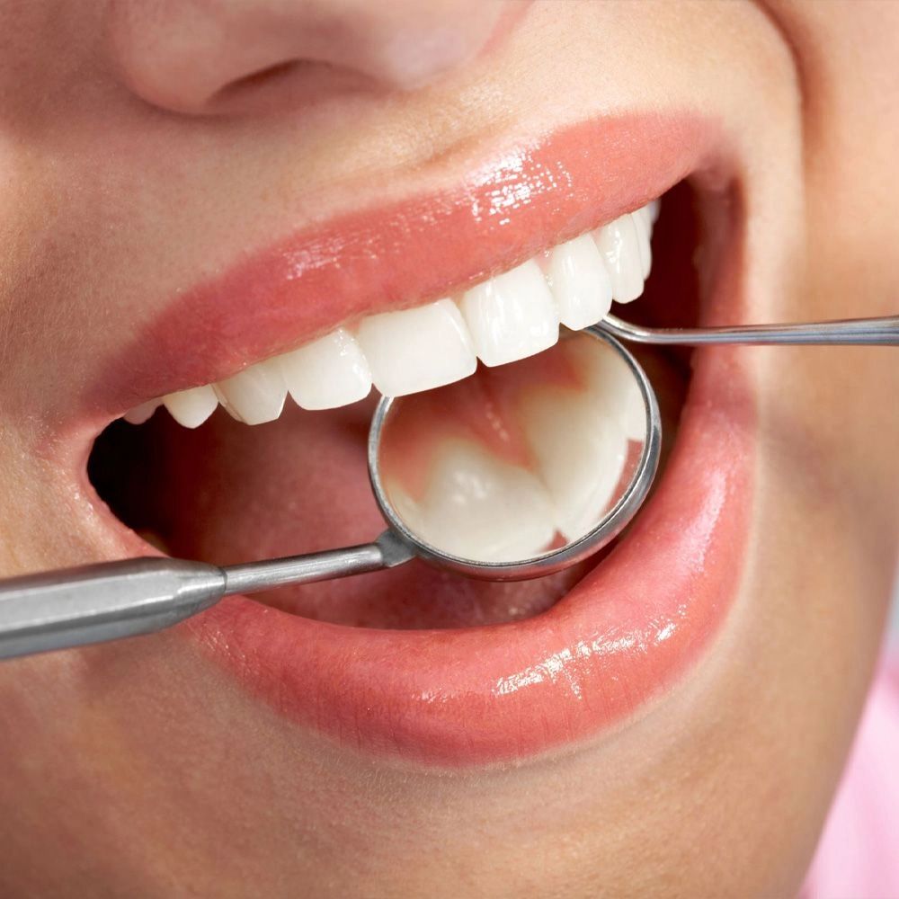Can Deep Cavities Be Treated When Traveling To Chinese Mainland for Dental Care