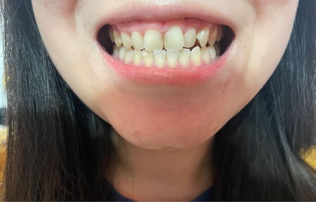 Reliable Reviews for Dental Work To Chinese Mainland
