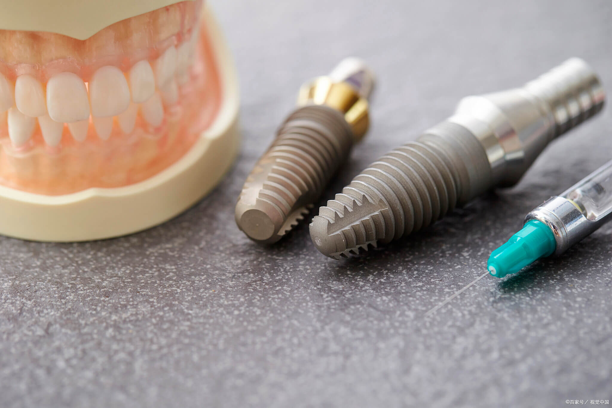 After heading north for dental implants, could the gum recession and pain be due to excessive stress