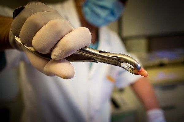 Dental Tourism Reviews for New Zealand Safety and Recovery Experiences Abroad