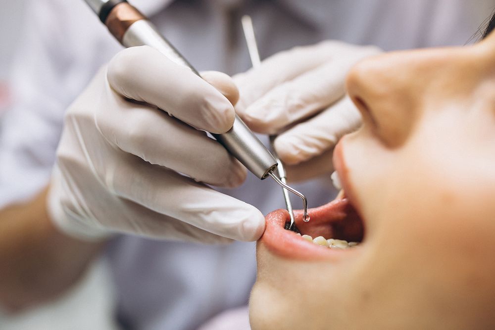 Cheap Crowns Overseas for New Zealand Looking for Quality Dental Clinics