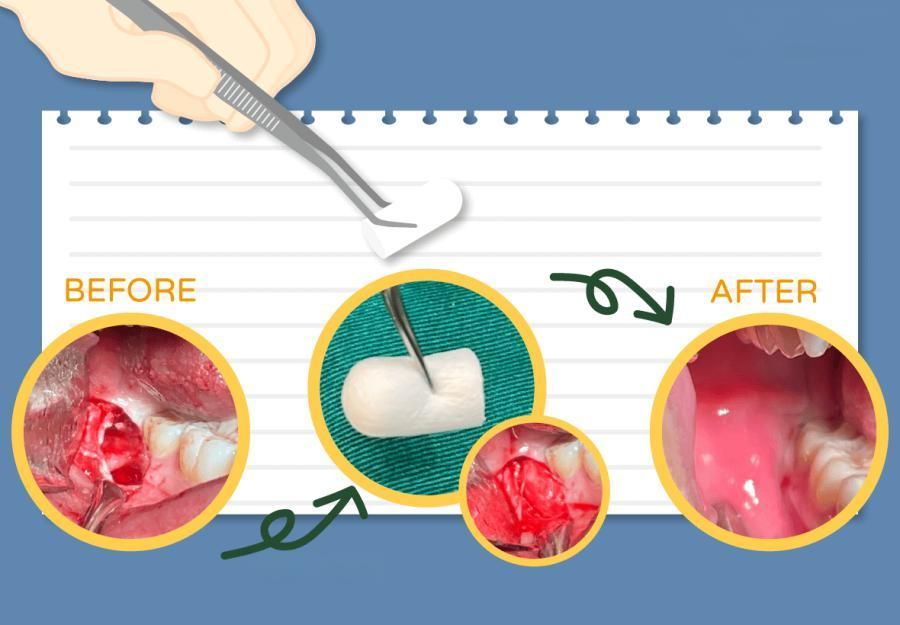 Cheap Dentist Overseas for New Zealand Patients Looking to Save on Dental Care
