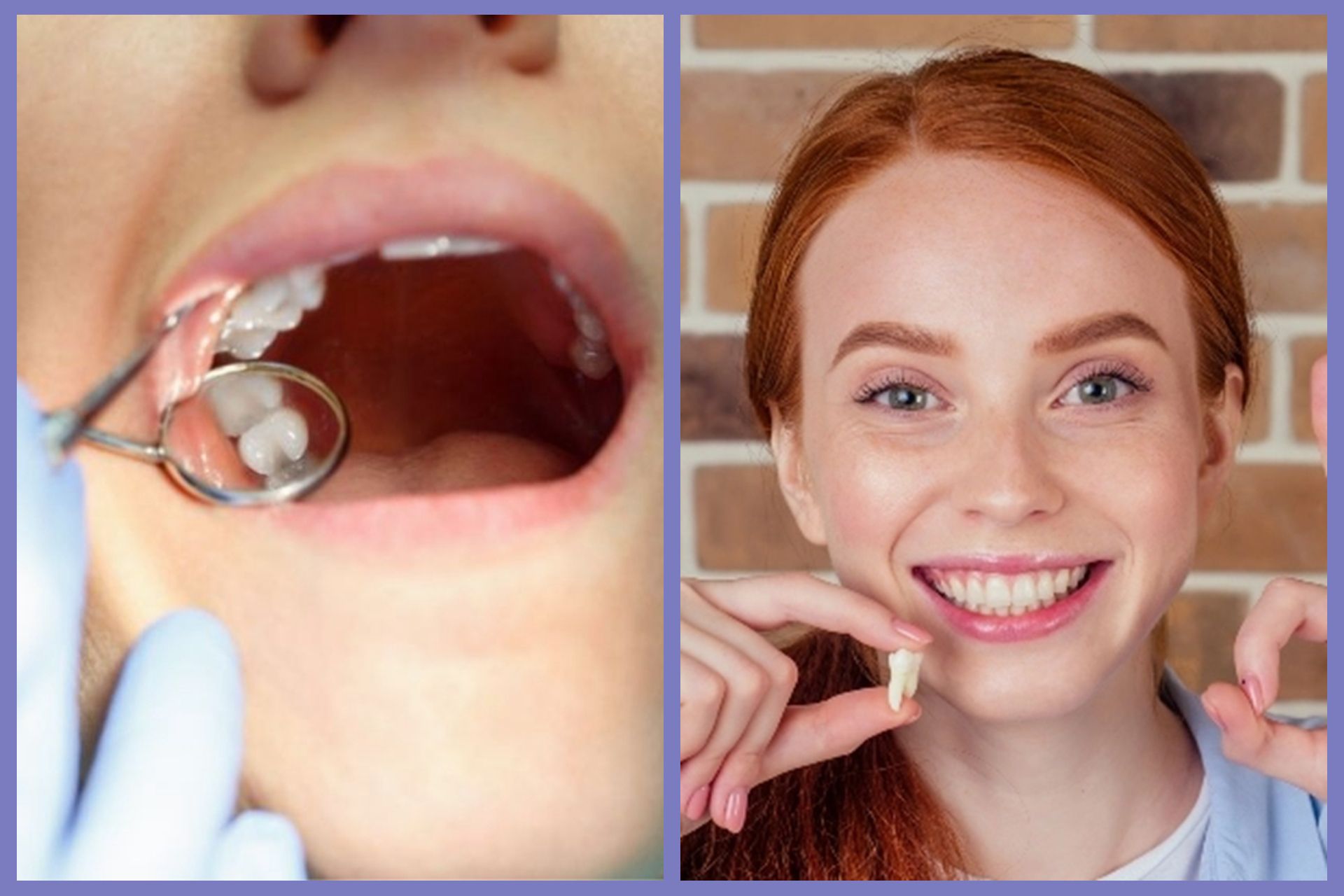 Affordable Dentistry Abroad for New Zealand Compared with Local Clinic Prices