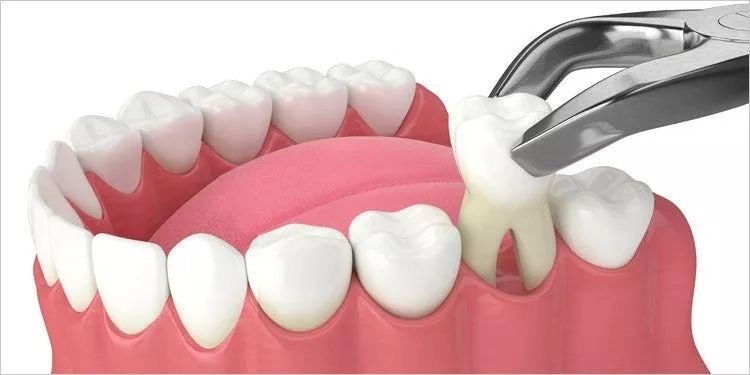 Overseas Dental Packages Australia Travel Planning and Recovery Advice