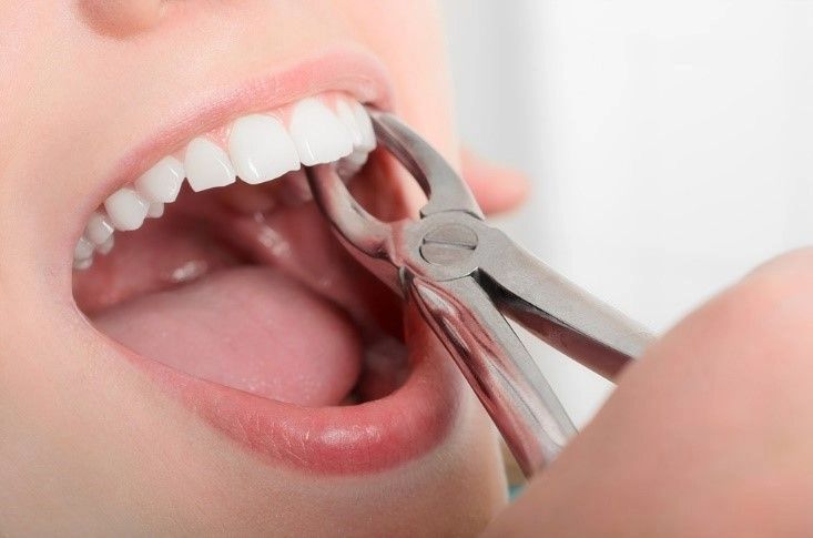 Dental Tourism Insurance New Zealand Guide for Safe Overseas Dental Travel