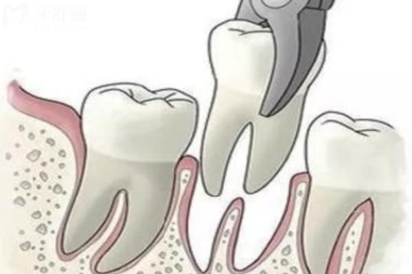 Dental Tourism Australia Best Destinations for Affordable Treatment