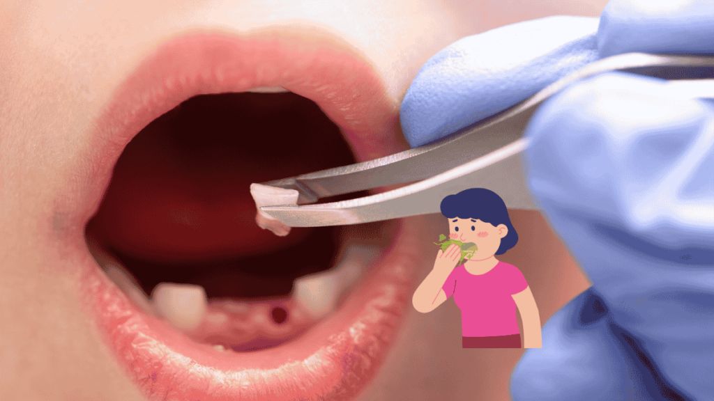 Dental Cost Comparison New Zealand vs Thailand Dental Treatment Prices