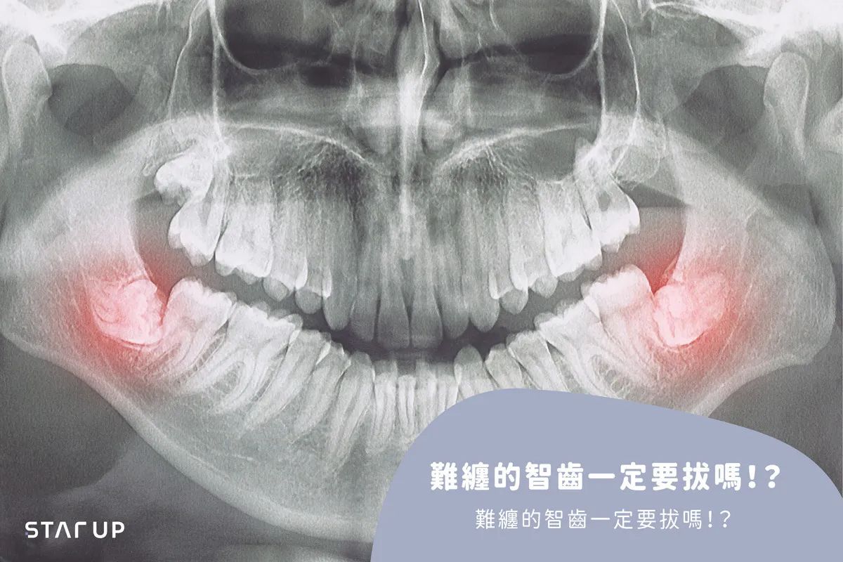 Dental Tourism Reviews for Aussies Looking for Trusted International Providers