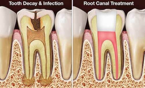 Will Traveling North to Duyan Affect Overall Oral Health