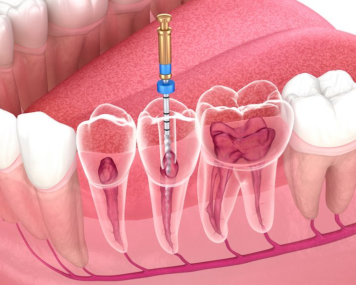 Will Orthodontic Treatment at Dakeng Affect Facial Appearance