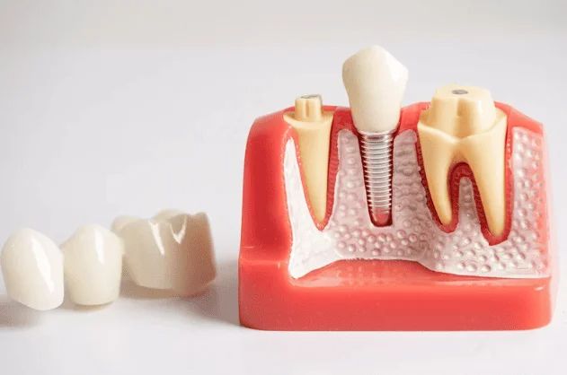 Will the Dentists in Bukit Timah Provide Immediate X-Ray Explanations