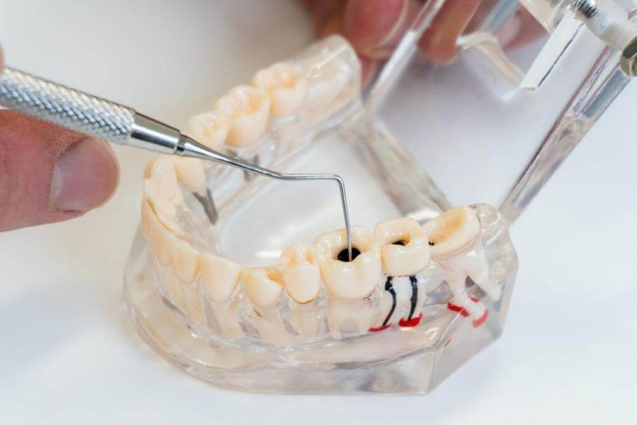 Which Dental Issues Are Suitable for Orthodontic Treatment in Duyagen, Northbound