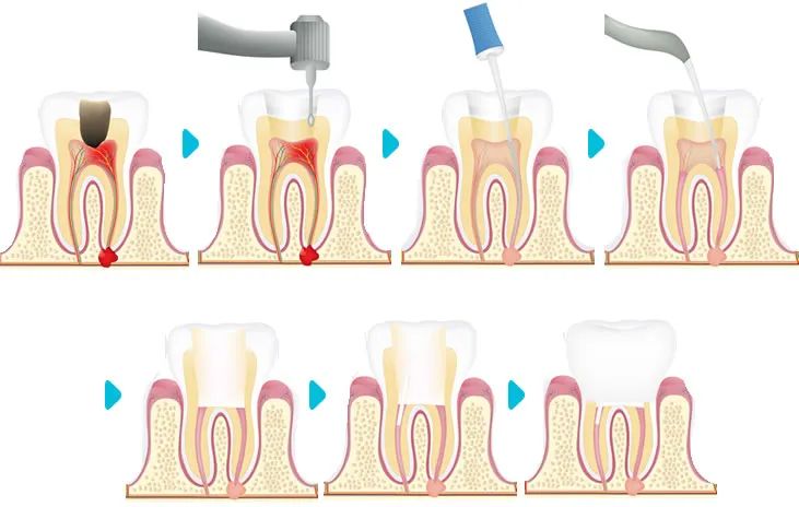 Is North Duyagan Suitable for People Who Have Previously Had Braces
