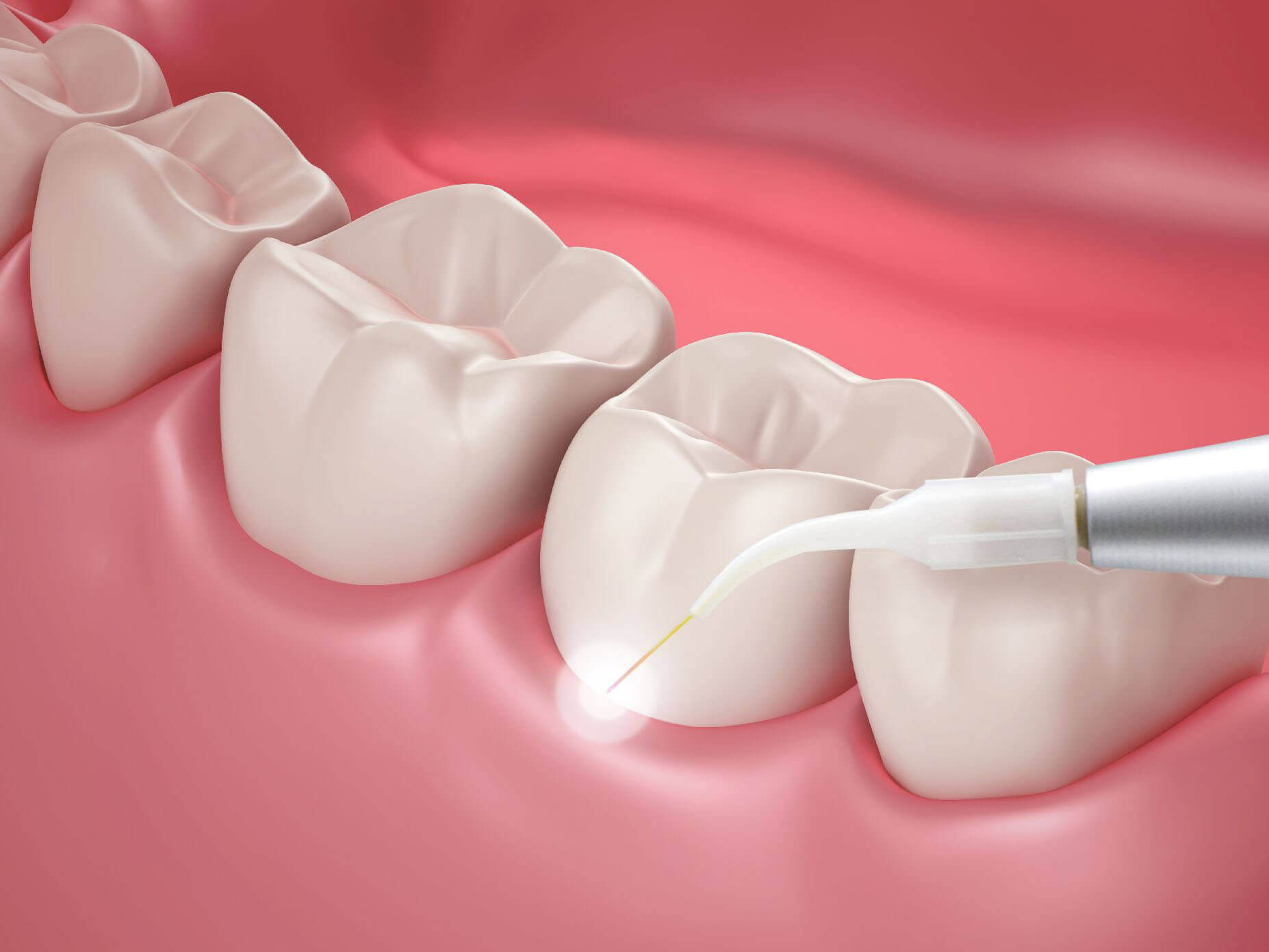 Does Beishang Dental Clinic offer group discounts for teeth cleaning