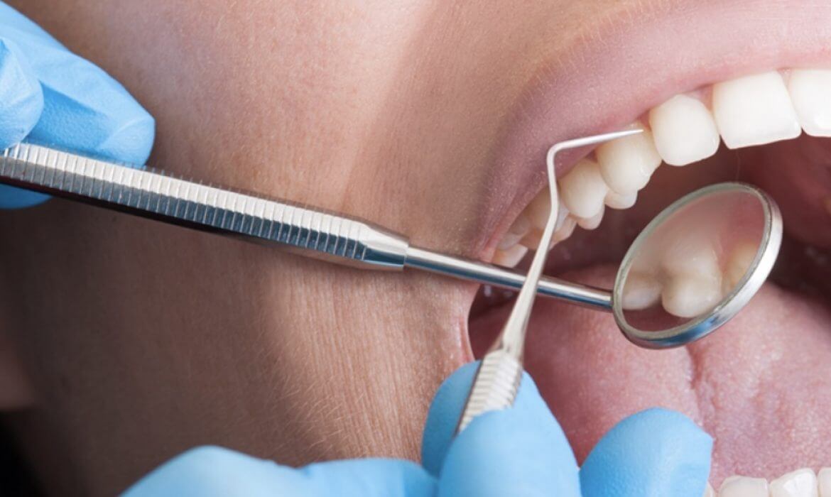 Is It Normal to Feel a Gritty Sensation on a Dental Crown After Getting a Dental Implant in Northern China