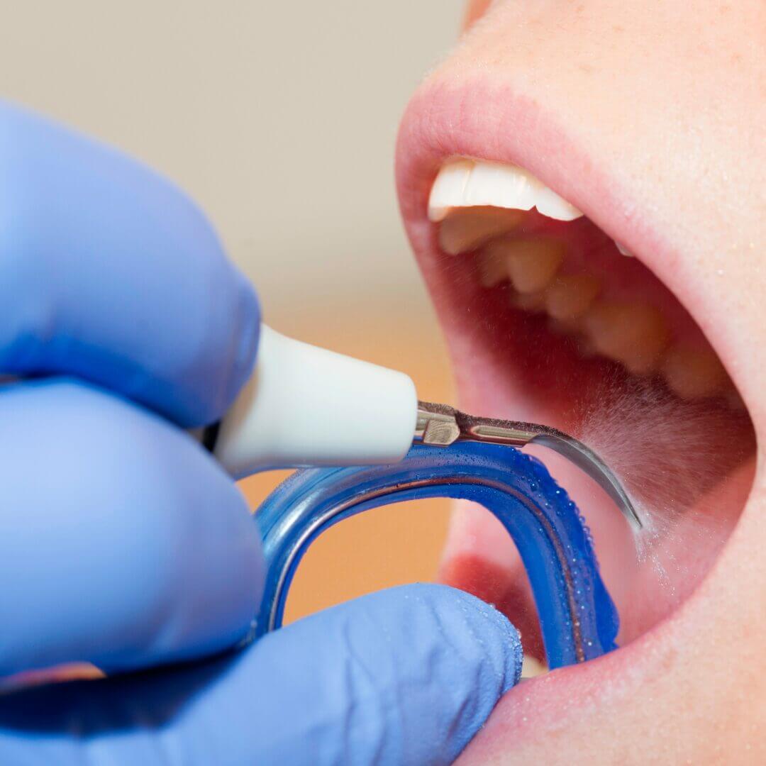 Does the dental clinic in the North provide X-ray services for teeth cleaning