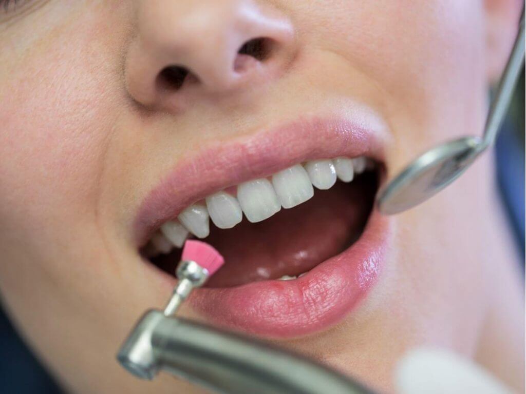 How to Handle Insufficient Jawbone When Getting Dental Implants in the North