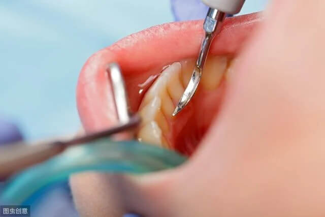 After getting dental implants in the north, is the difficulty in speaking due to the height of the dental crown