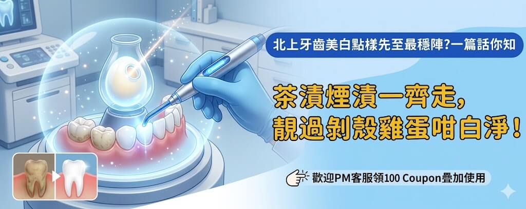 北上牙齒貼面美白過程需要幾耐時間