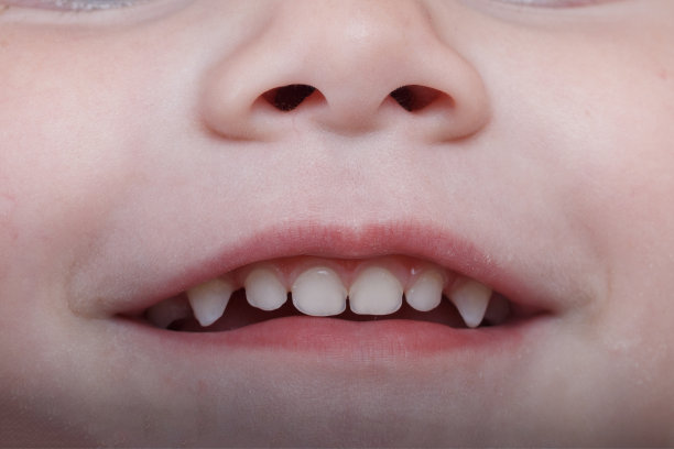 Revolutionizing Smile Restoration Through Innovative Dental Implant Treatment Techniques for Enhanced Oral Health and Aesthetics
