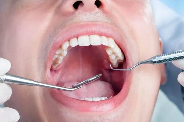 刷牙的重要性與正確方法讓口腔健康常伴你我