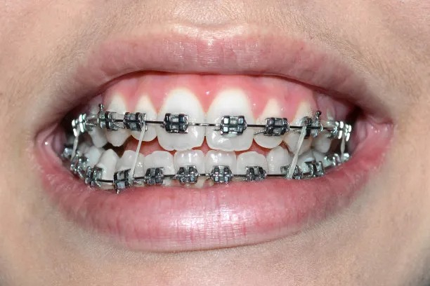 Essential Guidelines for Ensuring Safe and Effective Root Canal Treatment for Optimal Dental Health Essential Guidelines for Ensuring Safe and Effective Root Canal Treatment for Optimal Dental Health