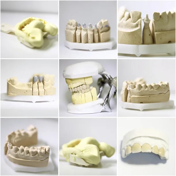 Transform Your Smile and Confidence with Cutting-Edge Dental Implants for a Brighter Future in Oral Health Transform Your Smile and Confidence with Cutting-Edge Dental Implants for a Brighter Future in Oral Health