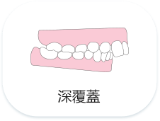 深圳隱形牙箍推薦