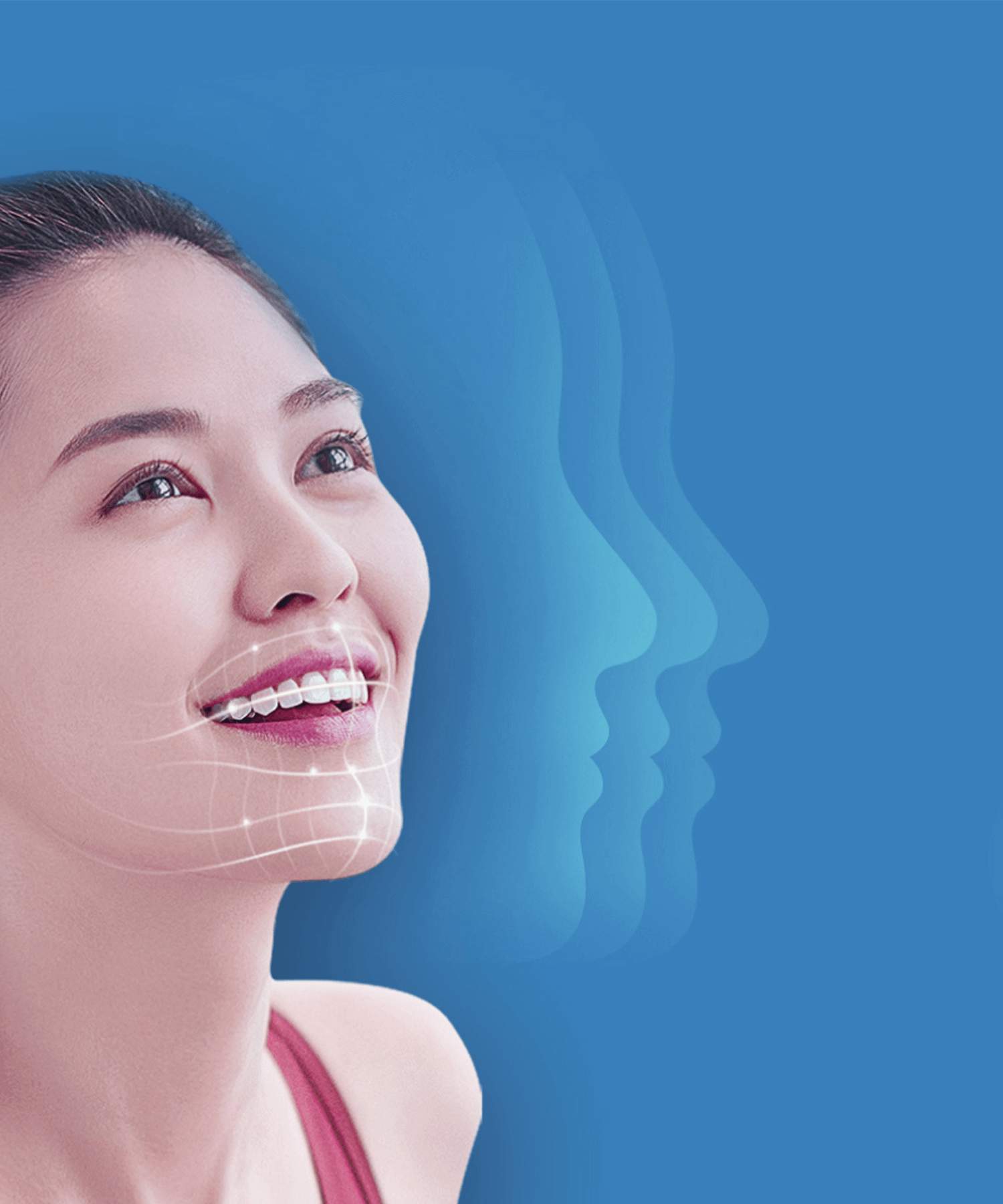 深圳隱適美價錢