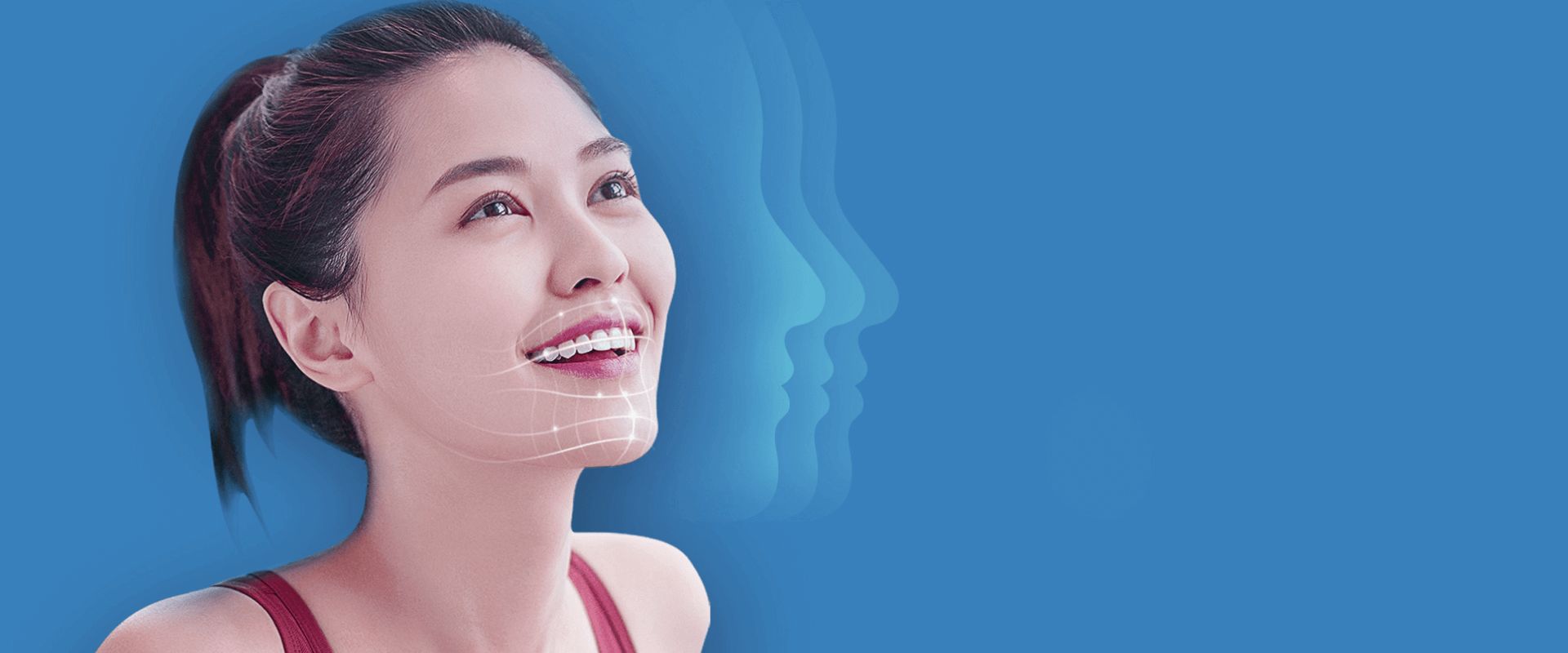 深圳隱適美推薦