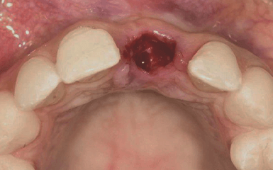 深圳脫智慧齒牙醫
