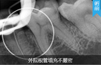 深圳杜牙根推介