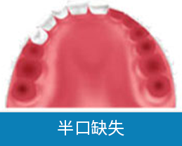 深圳種牙推介