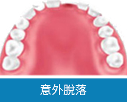 深圳全口植牙價錢