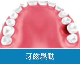 深圳全口植牙收費