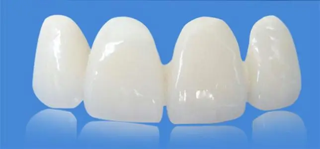 鑲個全瓷牙能用多久？有什麼優勢？最好的全瓷牙是哪種？
