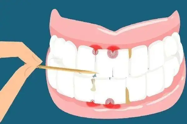 牙龈萎縮一定要治嗎？