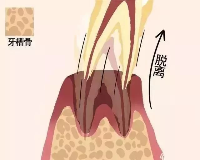 人到中年躲唔過脫髮，但可以躲得過牙齒鬆動