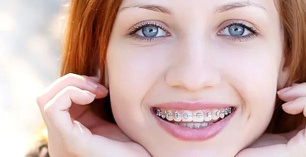 牙齒矯正的最佳時機是什麼時候？
