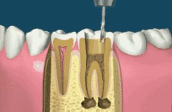 牙齒的咬合方式有幾種？