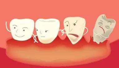 牙結石和牙垢如何進行區分？