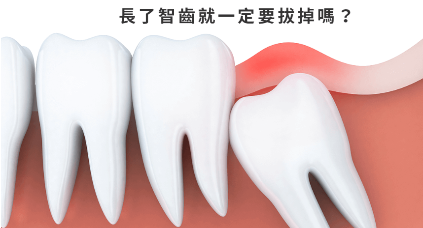 如何选择合适的澳门牙科诊所及智慧牙拔除指南